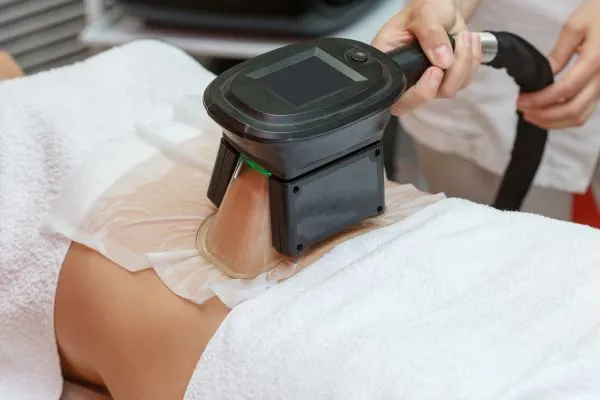 Image of person having fat freezing treatment to help weight gain Herefordshire