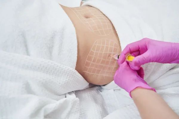 image of fat dissolving injections on love handles to help combat weight gain Herefordshire
