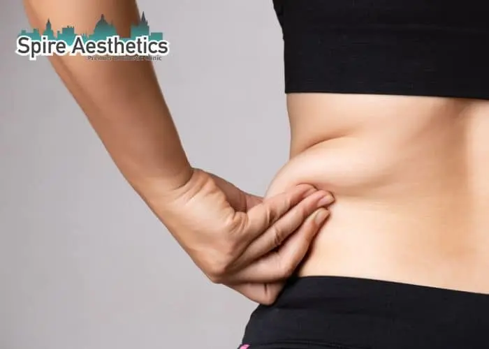 Image of woman pinching fat on their hips Herefordshire. Fat Freezing treatment