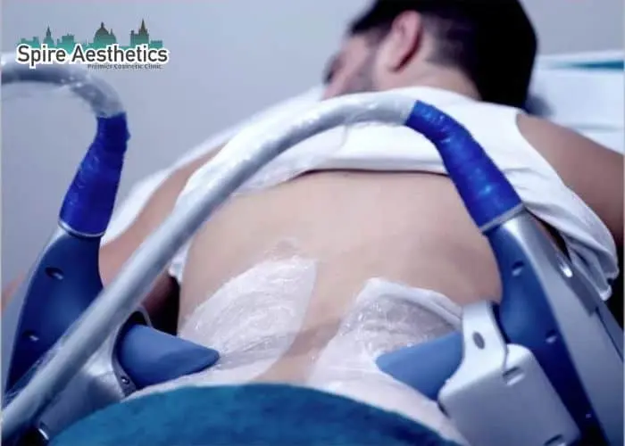 Man having fat freezing treatment done on love handles before a competitions Herefordshire to create a sculpted look.