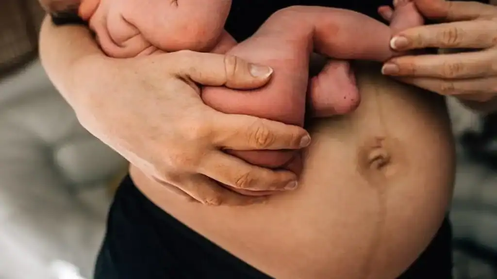 Why Is My Stomach Still Big After Pregnancy Herefordshire?