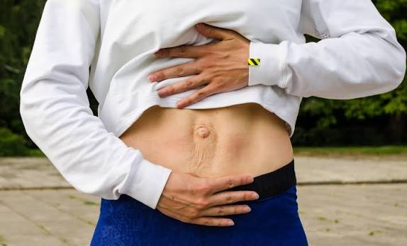 When Could Diastasis Recti Be the Missing Piece of the Puzzle Herefordshire?
